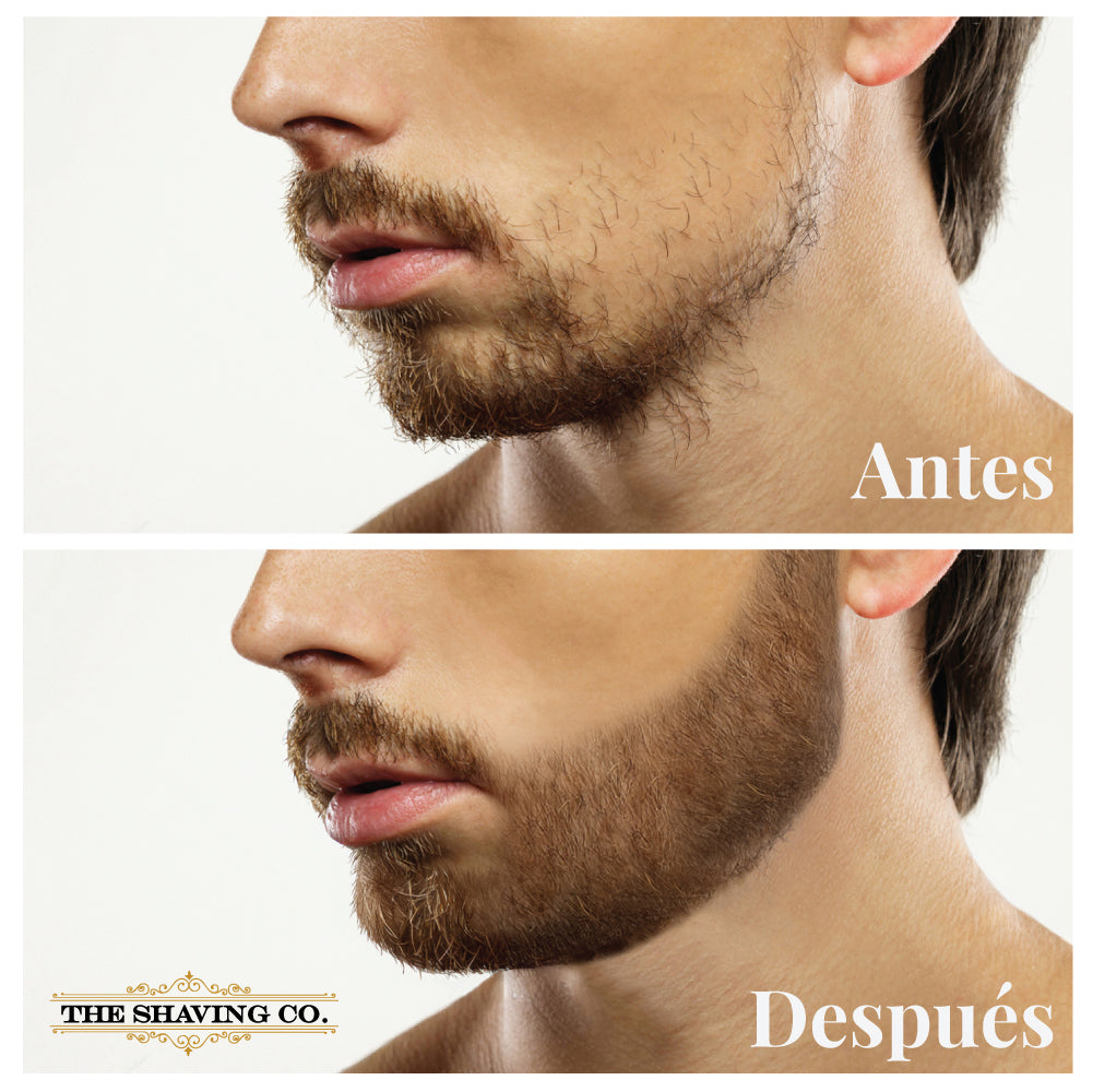 Crecer Como Alisar La Barba De Forma Natural Kit De Crecimiento De