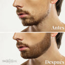 DERMO - ROLLER PARA BARBA Y BIGOTE Y CAPILAR
