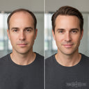 The Shaving Co. SISTEMA CAPILAR (DUO) Loción y Shampoo Capilar Noxidil - H2  TSC-502