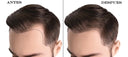 Locion Capilar Noxidil - H2  The Shaving Co. TSC-504
