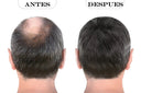 The Shaving Co. SISTEMA CAPILAR (DUO) Loción y Shampoo Capilar Noxidil - H2  TSC-502